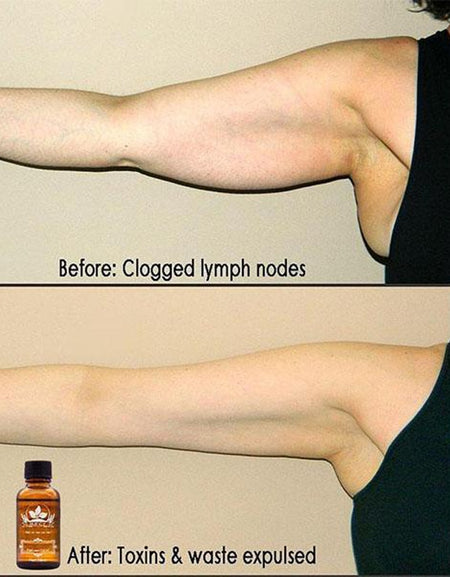 Natural Plant Therapy Lymphatic Drainage Ginger Oil