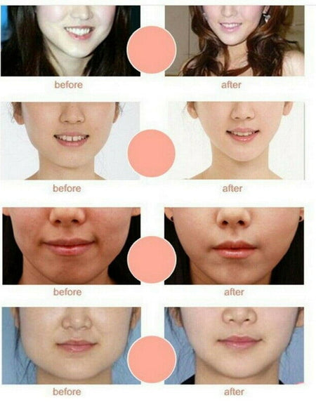 Miracle V-Shaped Lifting Facial Neck Mask