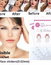 V-Shape Face Lift