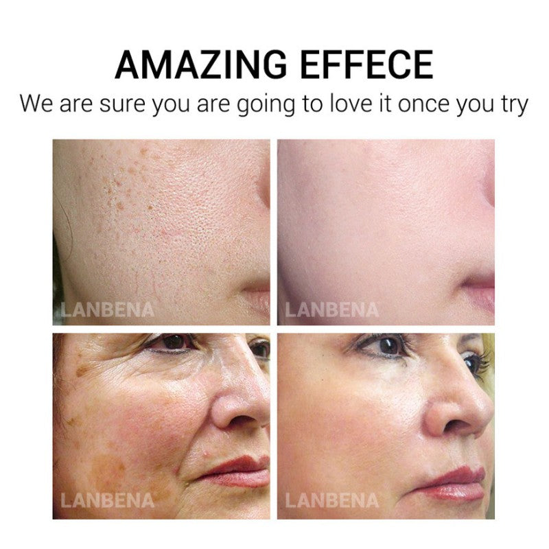 Face Masks Hyaluronic Acid