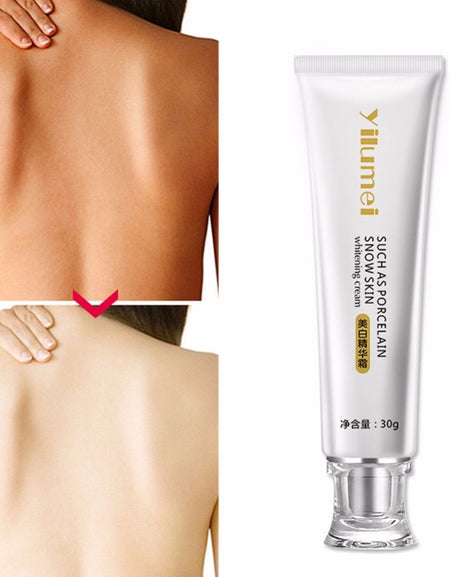Whitening Cream Skin Bleaching Whole Body Lotion