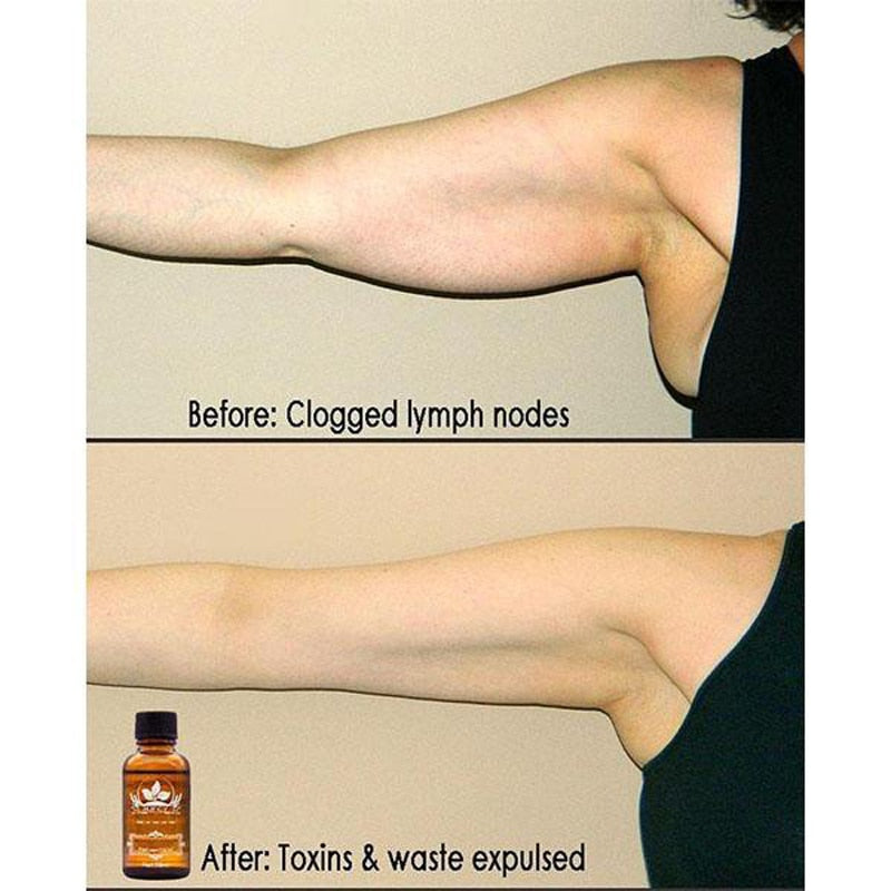 Natural Plant Therapy Lymphatic Drainage Ginger Oil