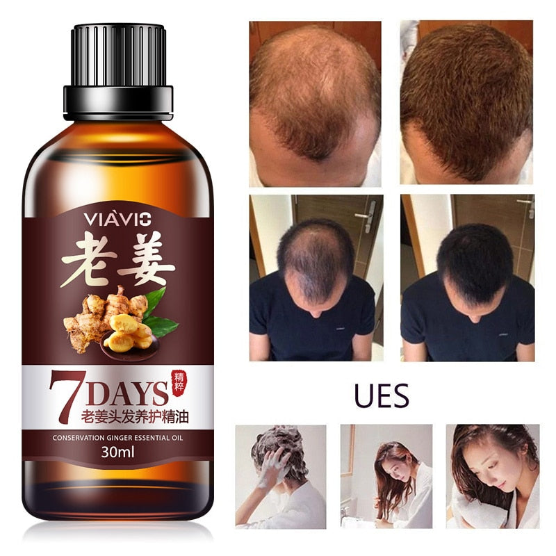 Ginger Fast Hair Care Growth Oil Anti Hair Loss Products