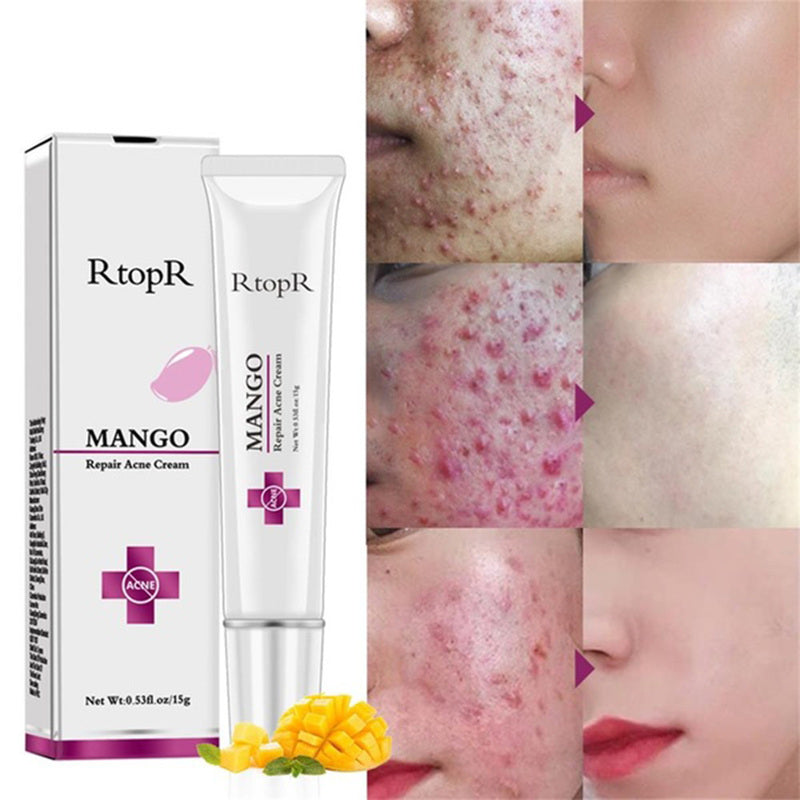 Mango Repair Acne Cream
