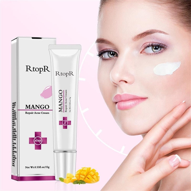 Mango Repair Acne Cream