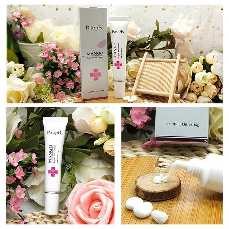 Mango Repair Acne Cream