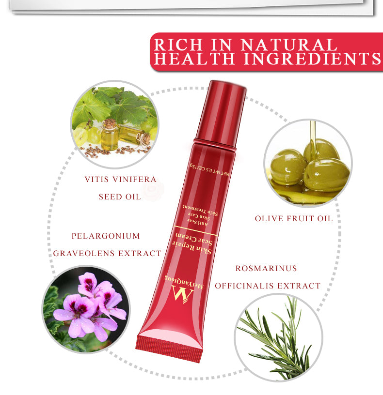 Acne Scar Stretch Mark