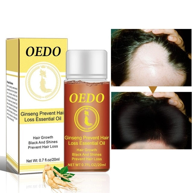 Ginseng Hair Growth Essence Oil Anti-Hair Loss