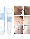 Removal Cream Skin Repair