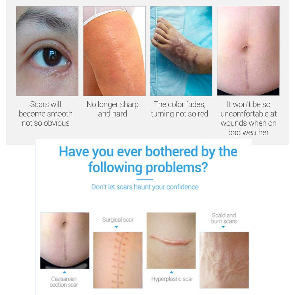 Removal Cream Skin Repair