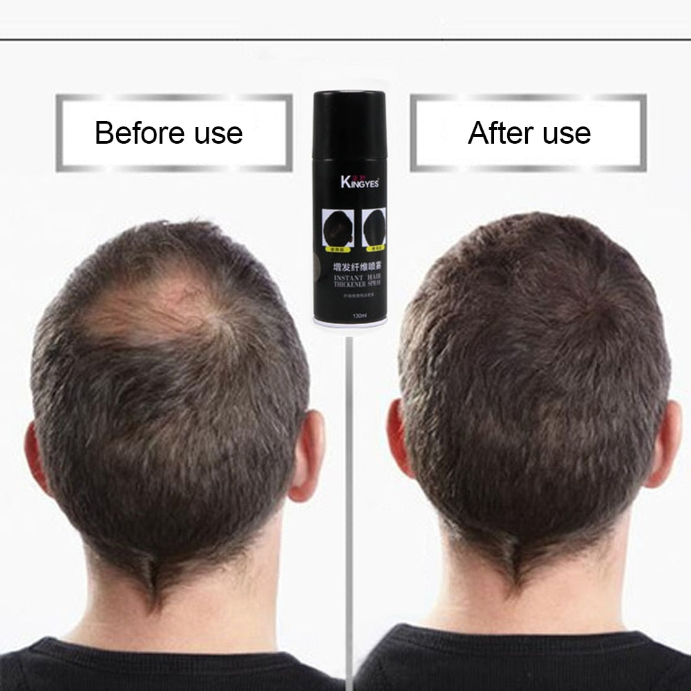 Hair Care Growth Essence Treatment of Hair Loss