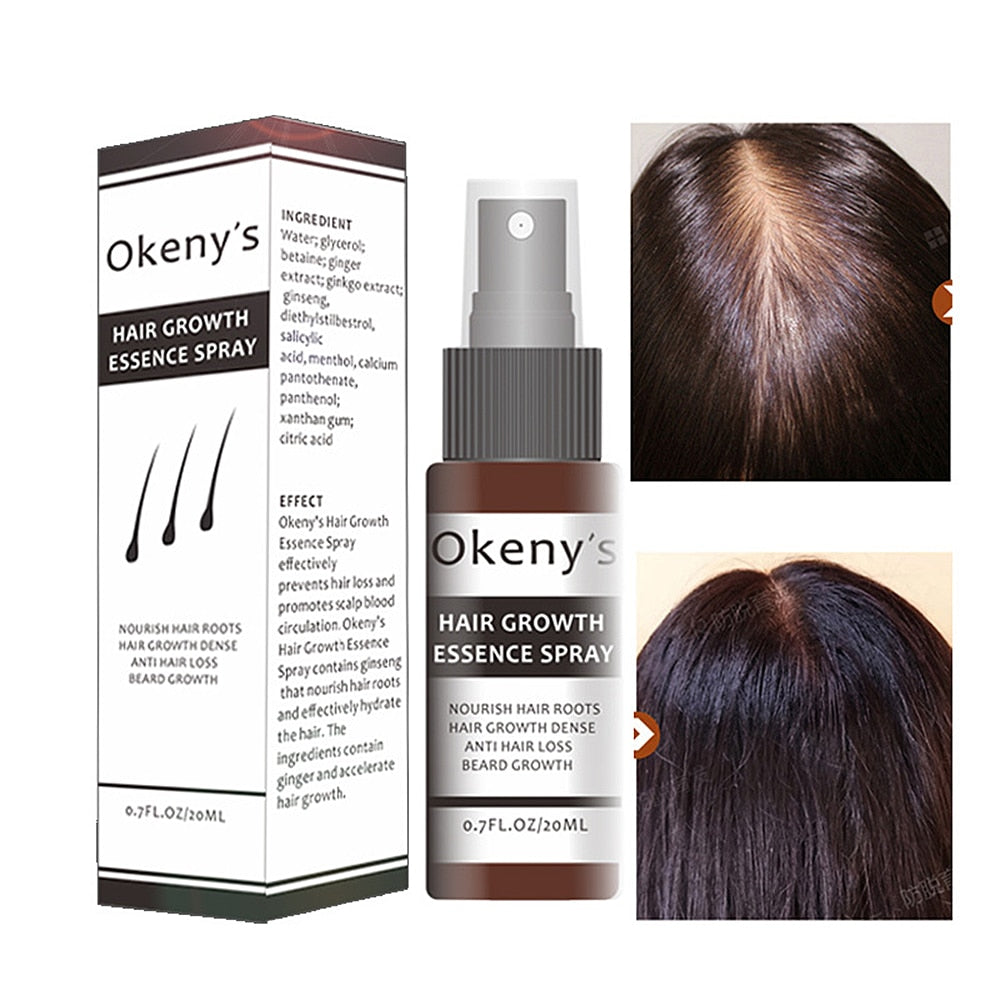 Hair Care Growth Essence Treatment of Hair Loss