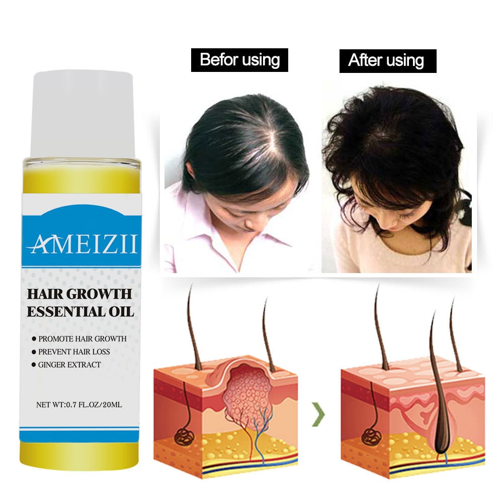 Hair Loss Growth Essence oil