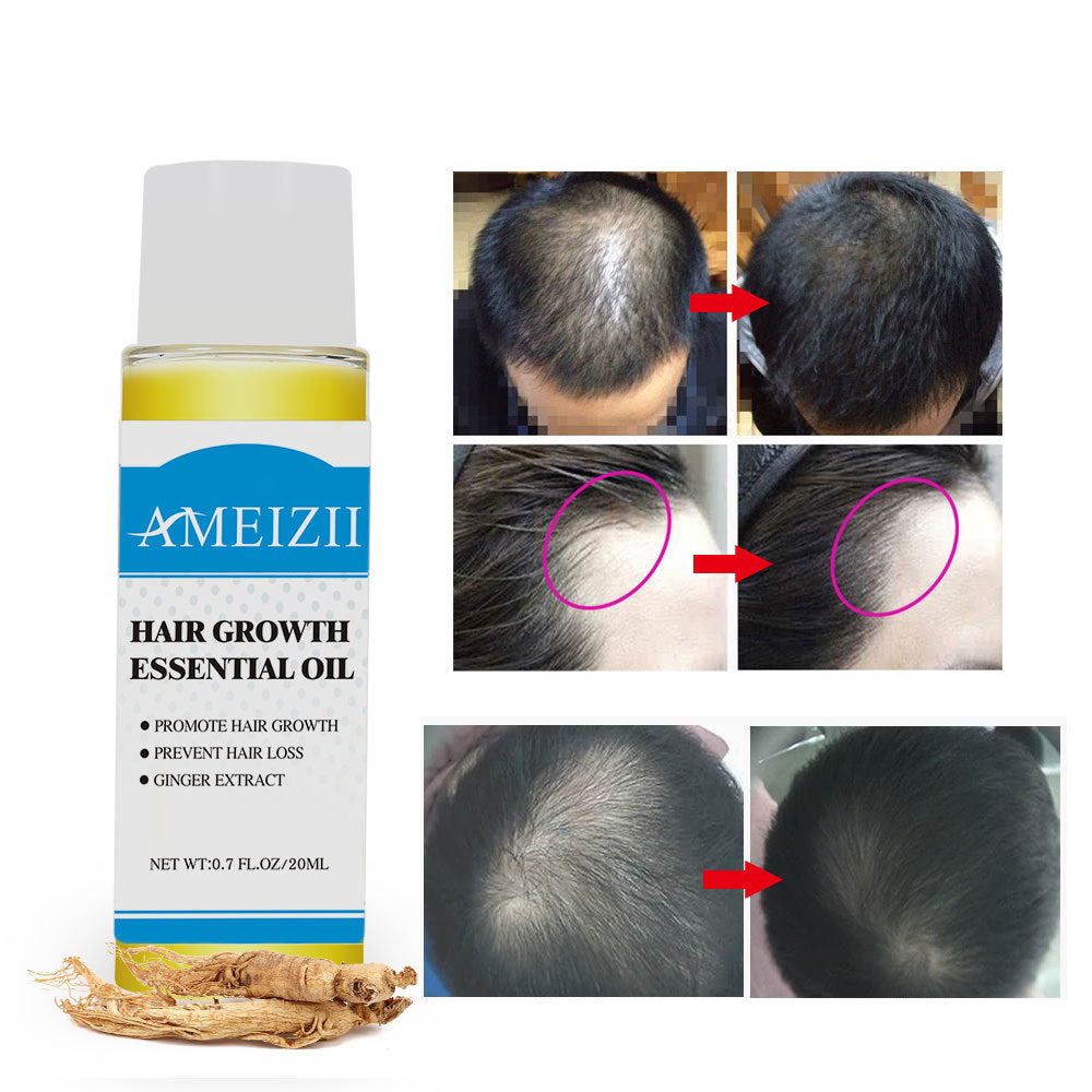 Hair Loss Growth Essence oil